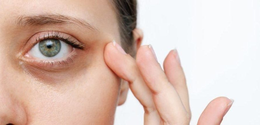 Le traitement des cernes : retrouver un regard reposé et lumineux